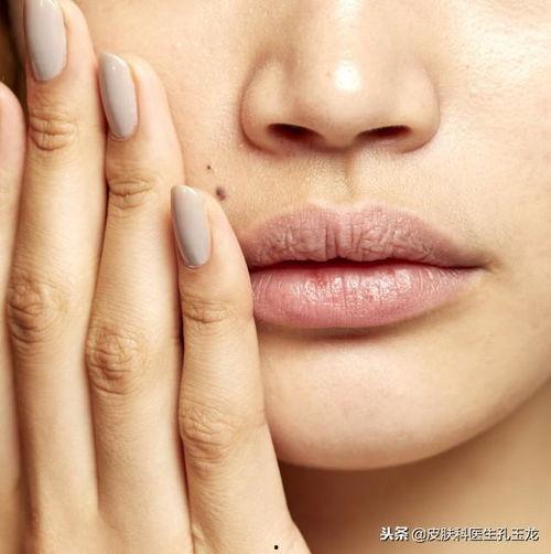 吃白瓜嘴巴刺痛,揭秘原因及应对策略